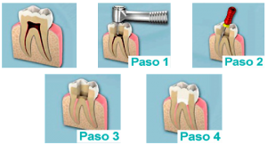 endo1